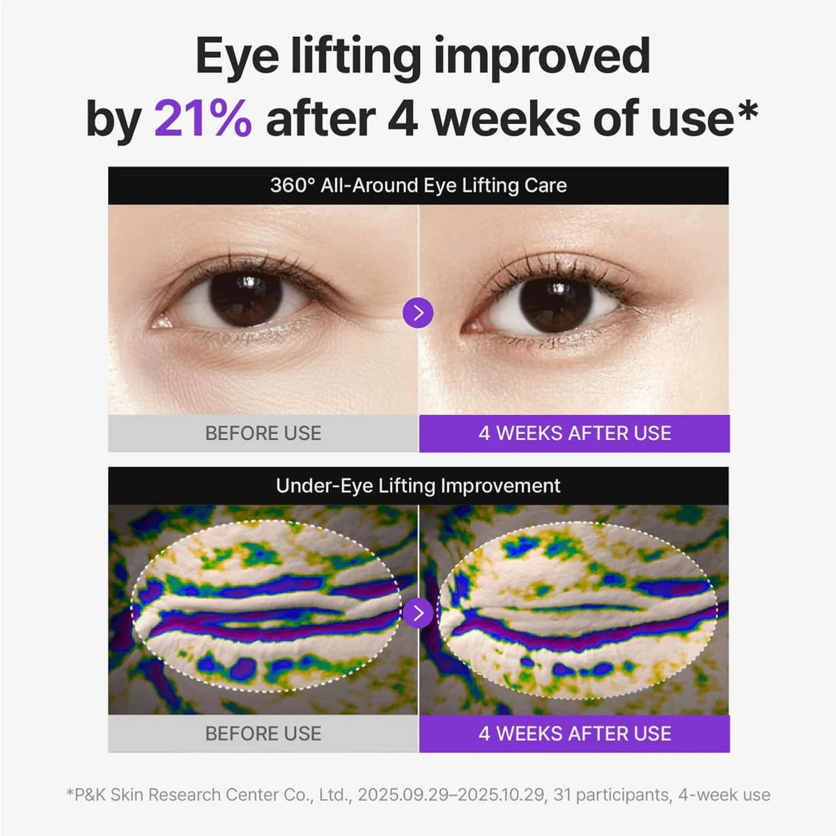 Centellian24 360º Shot PDRN Lifting Eye Cream 30 ml